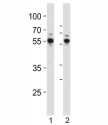 Western blot analysis of lysate from 1) Jurkat and 2) Molt-4 cell line using RUNX1 antibody at 1:100