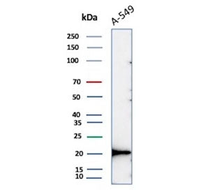 Western blot testing of human A549 cell lysate with recombinant Bax antibody (clone BAX/8960R). Pred