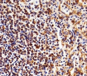 NFKB1 Antibody (p105)