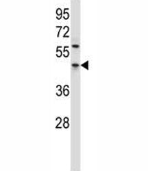 PDCD4 Antibody