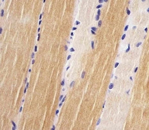 IHC testing of FFPE human skeletal muscle with Titin antibody at 1:25. HIER: steamed in pH6 citrate 