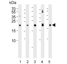 GPX3 Antibody
