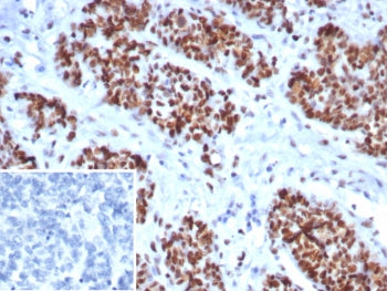 MSH6 Antibody