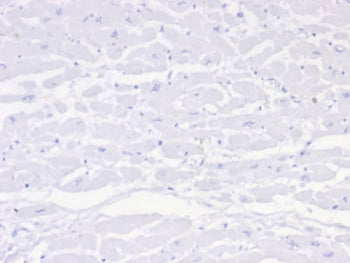 IHC staining of FFPE human heart tissue with Negative control antibody (clone IGG1/453). HIER: boil 
