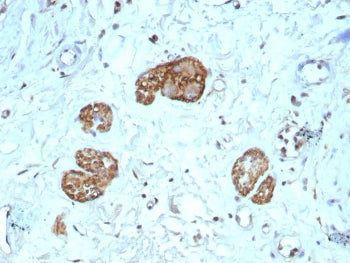 IHC staining of FFPE human colon tissue with recombinant CD56 antibody (clone NCAM1/9121R). HIER: bo