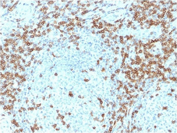 IHC staining of FFPE human tonsil with CD5 antibody (clone CD5/2418). Required HIER: boil tissue sec