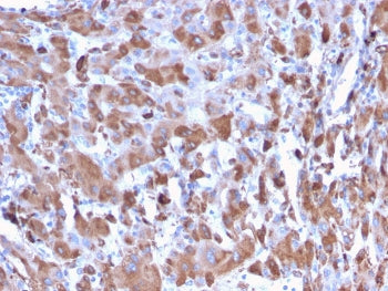 C1QA Antibody / Complement C1q A-Chain