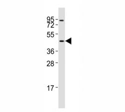 Western blot testing of CCR1 antibody at 1:2000 dilution + Jurkat whole cell lysate; Predicted molec