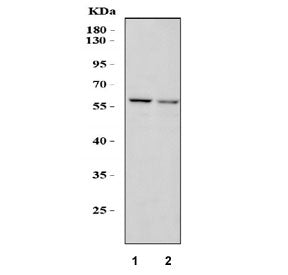 Western blot testing of 1) rat liver and 2) mouse liver lysate with SMAD5 antibody. Expected molecul