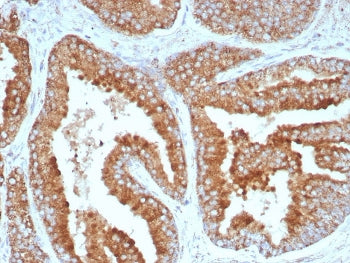 IHC staining of FFPE human prostate tissue with CD269 antibody (clone CD269/8508R). HIER: boil tissu