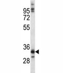 NKX6.1 Antibody