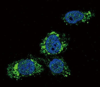 GCK Antibody / Glucokinase (N-Terminal Region)