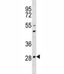 OSCAR Antibody