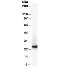 Western blot testing of A431 lysate with CBX1 antibody at 0.3ug/ml. Predicted molecular weight ~25kD