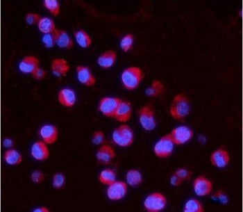 IL15RA Antibody