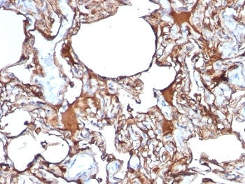 CD146 Antibody / MCAM / MUC18