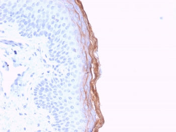 Kallikrein 5 Antibody / KLK5