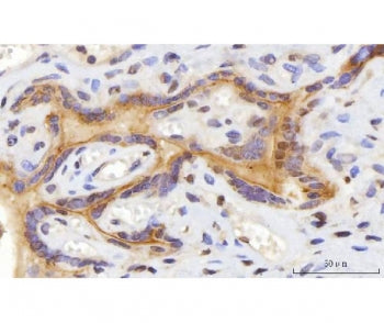IHC staining of FFPE human placental tissue with CEP250 antibody. HIER: boil tissue sections in pH8 