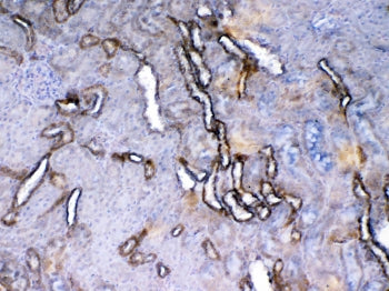 IHC testing of FFPE rat kidney tissue with Vegf receptor 2 antibody at 1ug/ml. Required HIER: steam 