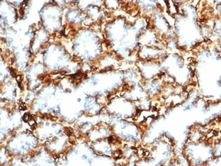 IHC staining of FFPE human kidney tissue with recombinant Wilms Tumor 1 antibody (clone WT1/3477R). 