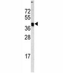 Western blot analysis of LOX antibody and MDA-MB468 lysate. Expected molecular weight: ~47 kDa (unpr
