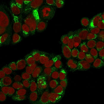 EBAG9 Antibody / Estrogen Receptor Binding Site Associated Antigen 9