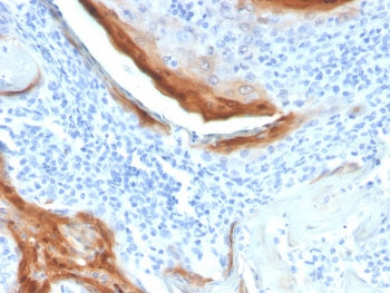 IL-1RA Antibody / Interleukin-1 Receptor Antagonist / IL1RN
