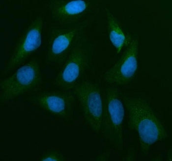 Immunofluorescent staining of FFPE human U-2 OS cells with CDC25B antibody (green) and DAPI nuclear 