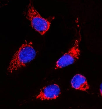 Immunofluorescent staining of FFPE human U-2 OS cells with Acetyl CoA Carboxylase 1 antibody (red) a