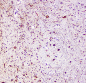 Calbindin Antibody / CALB1