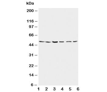Presenilin 2 Antibody