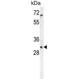 DcR3 Antibody / TNFRSF6B