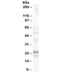 Western blot testing of K562 cell lysate with TIRAP antibody at 0.1ug/ml. Predicted molecular weight