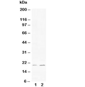 Western blot testing of 1) human HeLa and 2) rat PC-12 cell lysate with Bcl-XS antibody. Predicted/observed molecular weight: ~19 kDa.