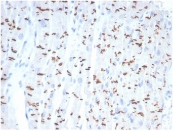 IHC staining of FFPE human heart tissue with recombinant Cadherin 2 antibody (clone CDH2/7070R). HIE