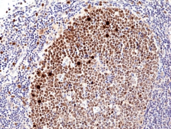 IHC testing of FFPE human tonsil tissue with recombinant Ki67 antibody. HIER: boil tissue sections i