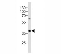 CD40 Antibody