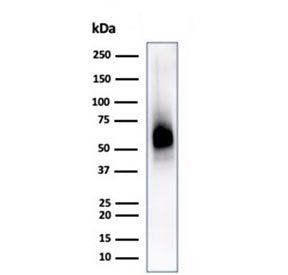 Western blot testing of human spleen lysate with CD63 antibody (clone LAMP3/2790). Predicted molecul