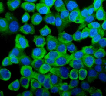 Immunofluorescent staining of FFPE human A431 cells with YB1 antibody (green) and DAPI nuclear stain