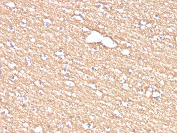 IHC staining of FFPE human brain with Myelin PLP antibody (clone PLP1/4259). HIER: boil tissue secti