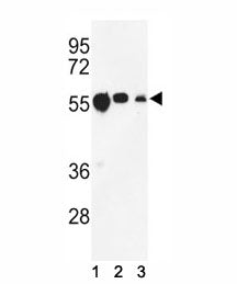 Tubulin beta 1 Antibody (TUBB1)