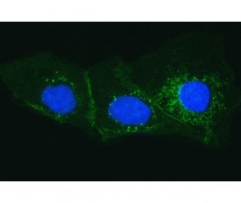 Tissue Factor Antibody / CD142
