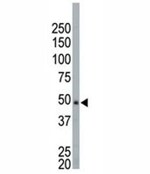 NEK2 antibody used in western blot to detect NEK2 in HeLa cell lysate