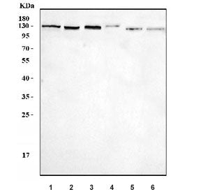 BCL11B Antibody / CTIP2