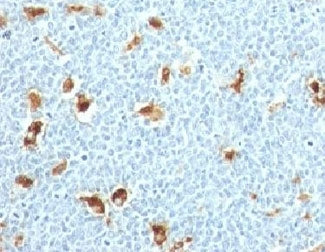 IHC: Formalin-fixed, paraffin-embedded human tonsil stained with S100A9 antibody (clone S100A9/1011)