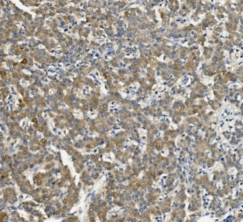 CYP2C19 Antibody / Cytochrome p450 2C19