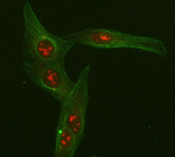 Immunofluorescent staining of FFPE human U-2 OS cells with FOXO3A antibody (red) and Beta Tubulin mA