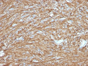 DOG1 Antibody / TMEM16A / ANO1