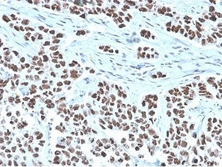 IHC staining of FFPE human lung tissue with NFIA antibody (clone PCRP-NFIA-2C6). HIER: boil tissue s