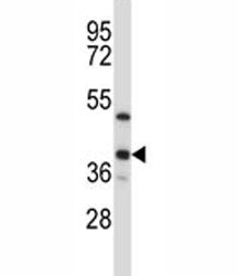 ERCC1 Antibody